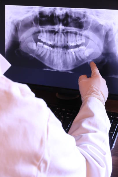 Best Emergency Tooth Extraction in Clearlake Riviera, CA