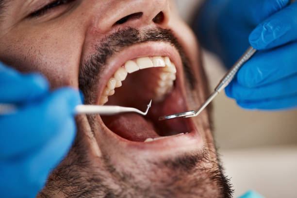 Best Walk-In Emergency Dentist in Clearlake Riviera, CA